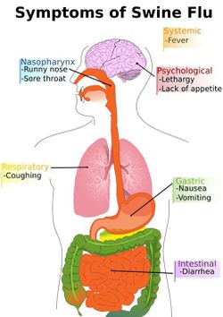 Swine-flue.jpg